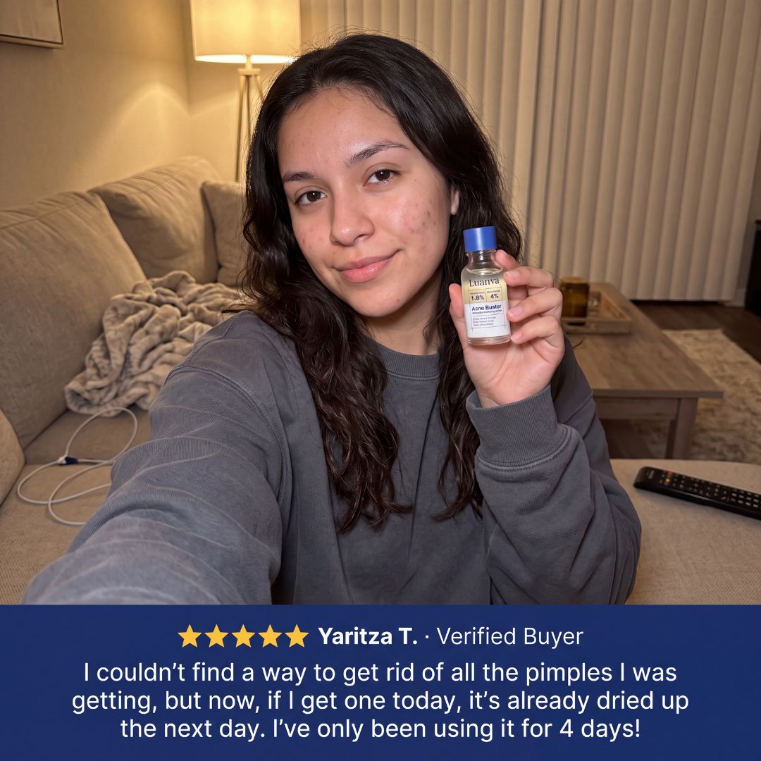 Luanva Acne Buster - Drying Lotion