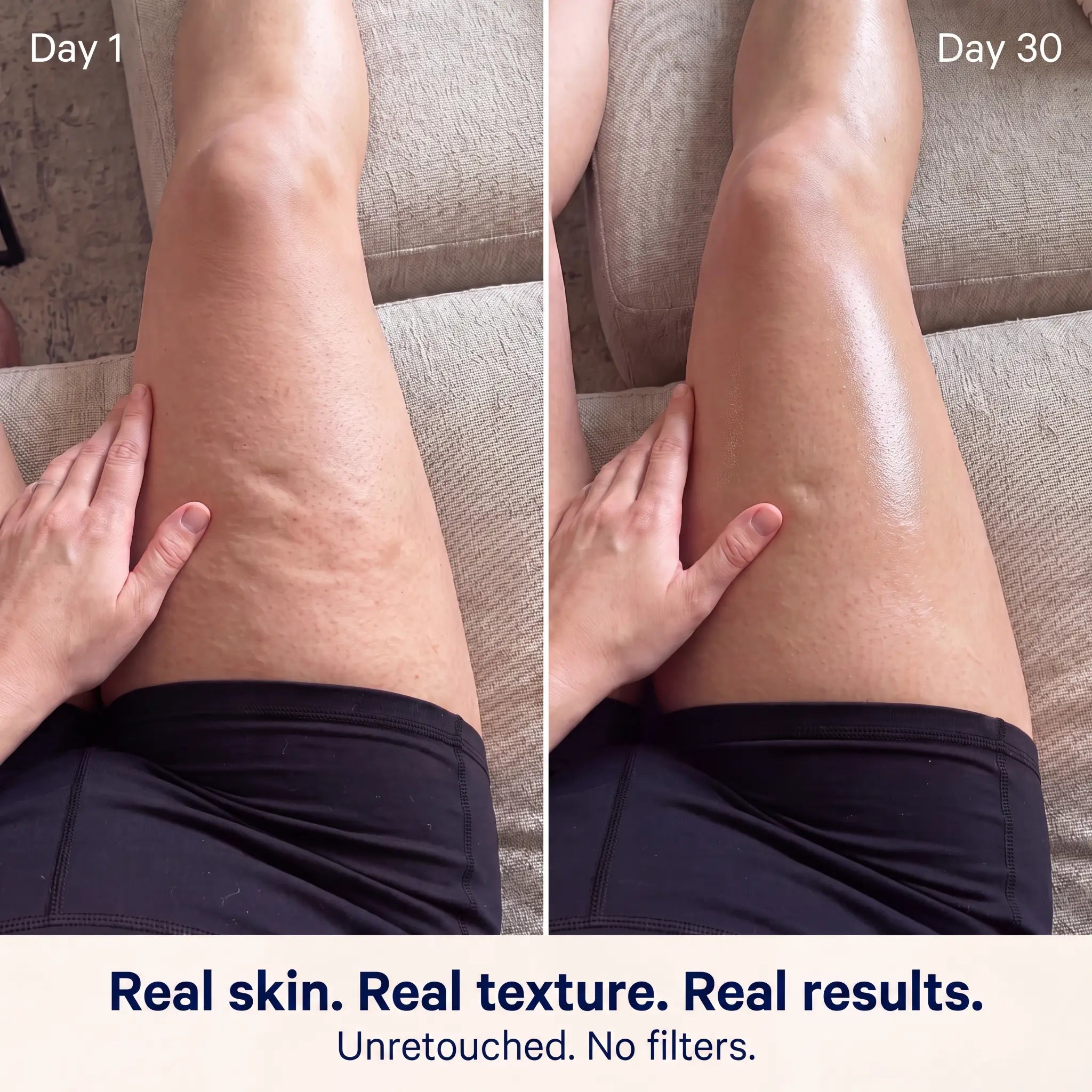 Cellulite Massage Oil