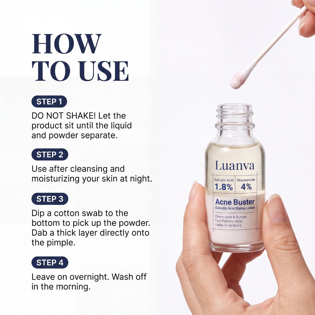 Luanva Acne Buster - Drying Lotion