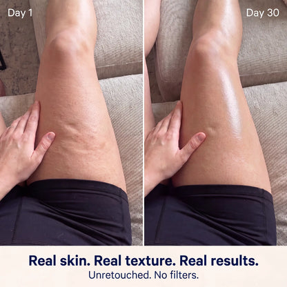 Cellulite Massage Oil